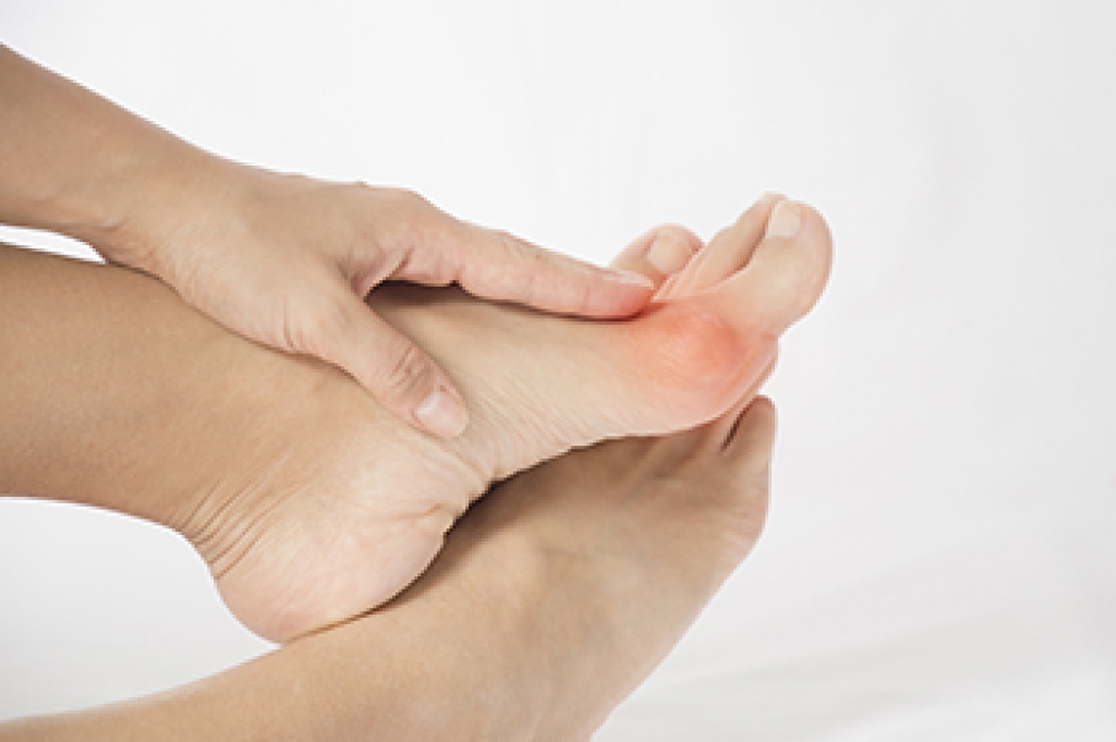 Bunions and How They Are Treated