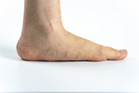 What Are the Causes and Symptoms of Flat Feet?